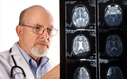Zlepšení kognitivních funkcí u Alzheimerovy nemoci po perispinálním podání etanerceptu