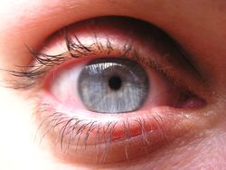 Za vznik kruhů pod očima může nejčastěji ucpaný nos